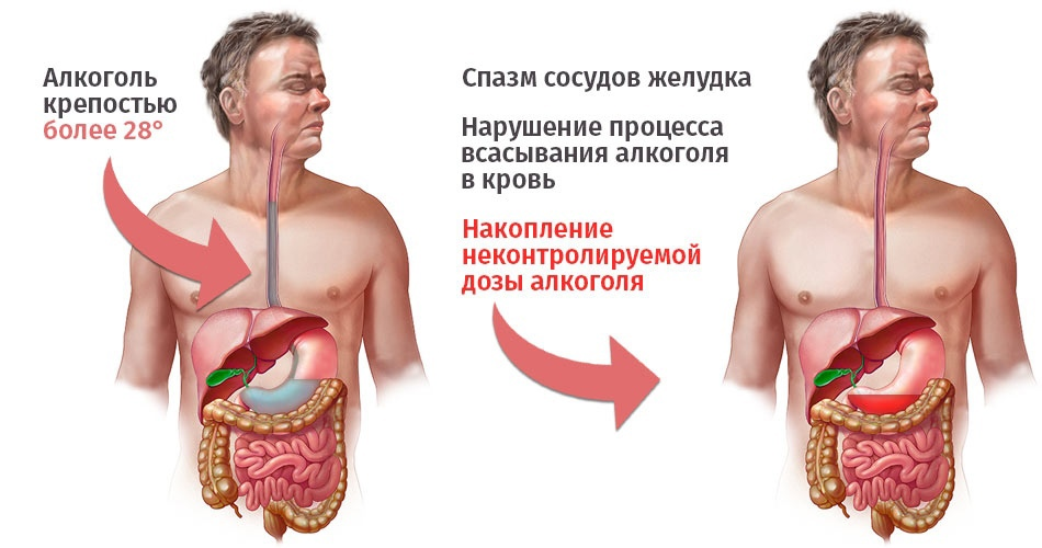 После алкоголя нормализуется стул